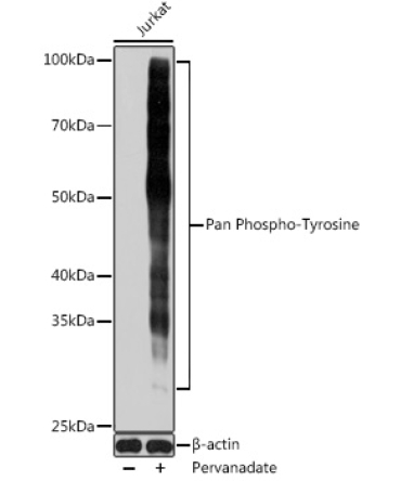 Pan Phospho-Tyrosine Mouse Monoclonal Antibody
