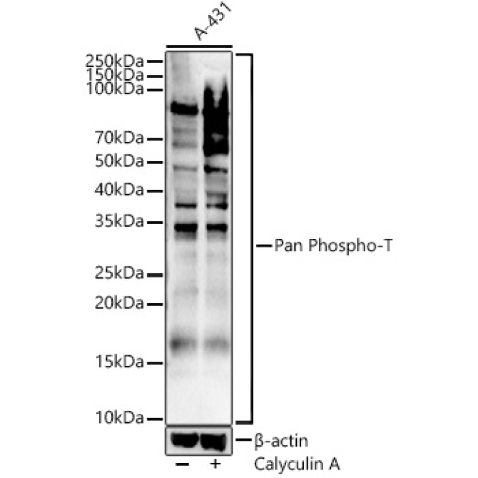 Pan Phospho-T Rabbit Polyclonal Antibody