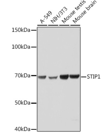 STIP1 Rabbit Monoclonal Antibody