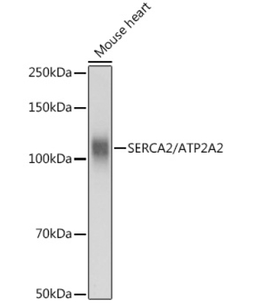 SERCA2/ATP2A2 Rabbit Polyclonal Antibody