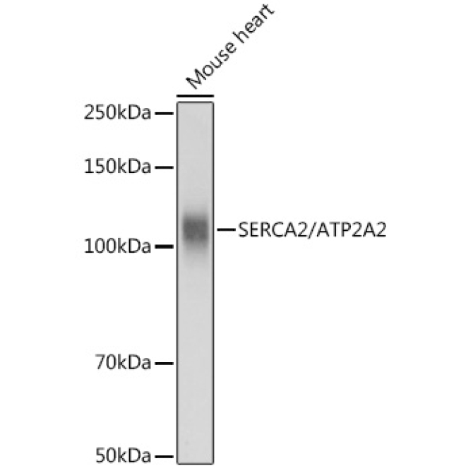 SERCA2/ATP2A2 Rabbit Polyclonal Antibody