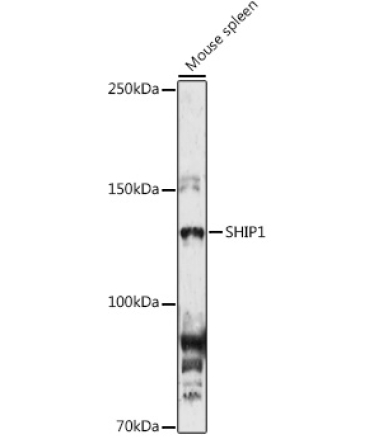 SHIP1 Rabbit Polyclonal Antibody