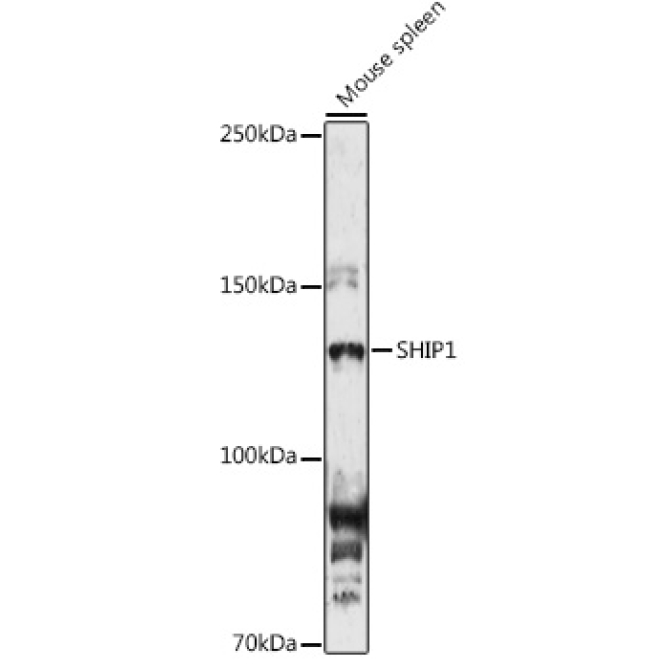 SHIP1 Rabbit Polyclonal Antibody