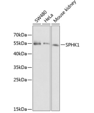 SPHK1 Rabbit Polyclonal Antibody