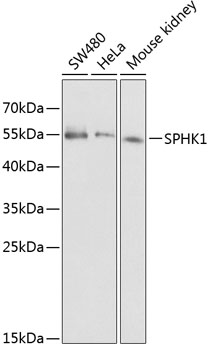 SPHK1 Rabbit Polyclonal Antibody
