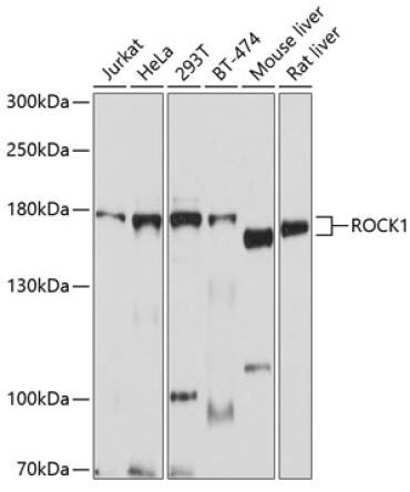ROCK1 Rabbit Polyclonal Antibody