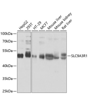 SLC9A3R1 Rabbit Polyclonal Antibody