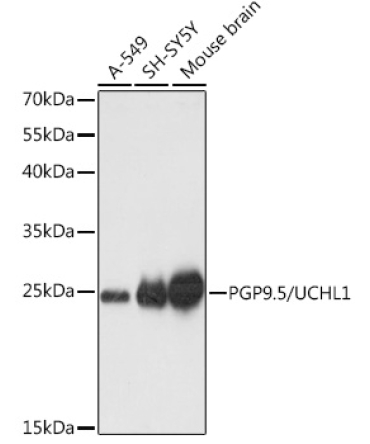 PGP9.5/UCHL1 Rabbit Polyclonal Antibody