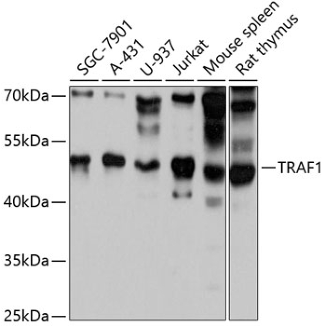 TRAF1 Rabbit Polyclonal Antibody