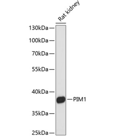 PIM1 Rabbit Polyclonal Antibody