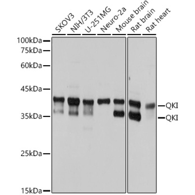 QKI Rabbit Monoclonal Antibody