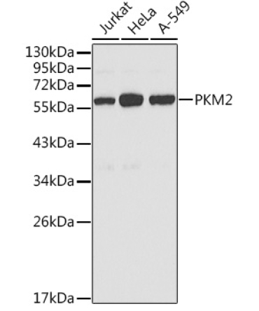 PKM2 Rabbit Polyclonal Antibody