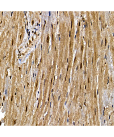 PPARGamma Rabbit Polyclonal Antibody