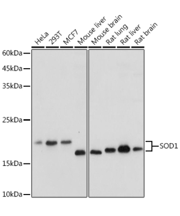 SOD1 Rabbit Polyclonal Antibody