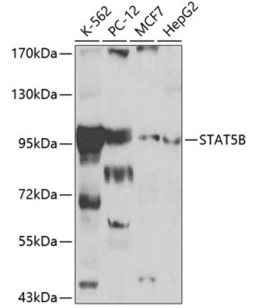 STAT5B Rabbit Polyclonal Antibody
