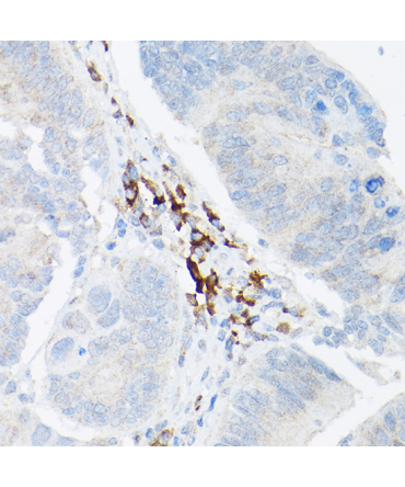 TNF-Alpha Rabbit Polyclonal Antibody