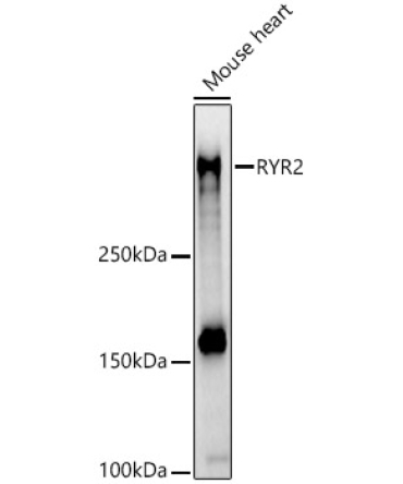 RYR2 Rabbit Polyclonal Antibody