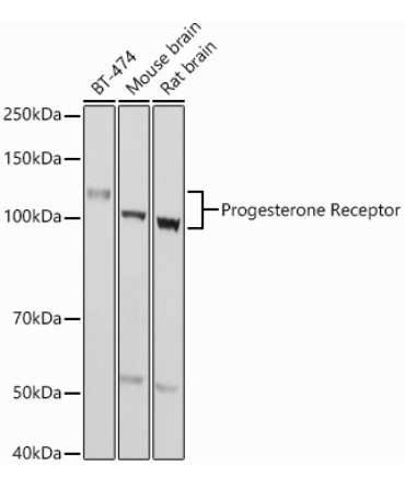 Progesterone Receptor Rabbit Polyclonal Antibody