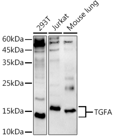 TGFA Rabbit Polyclonal Antibody