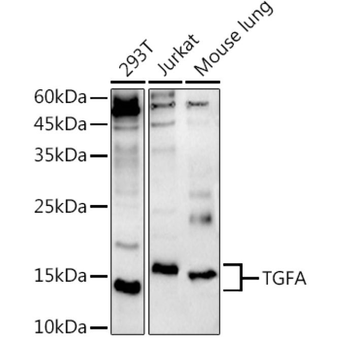 TGFA Rabbit Polyclonal Antibody
