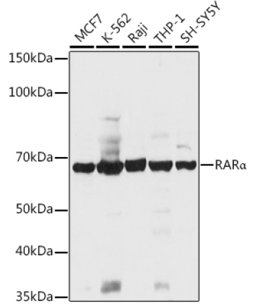 RARAlpha Rabbit Polyclonal Antibody