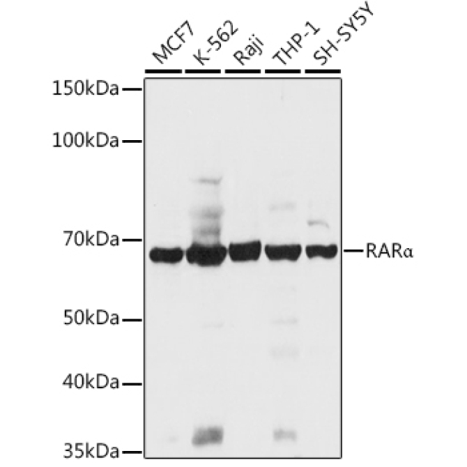 RARAlpha Rabbit Polyclonal Antibody