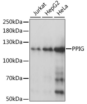 PPIG Rabbit Polyclonal Antibody