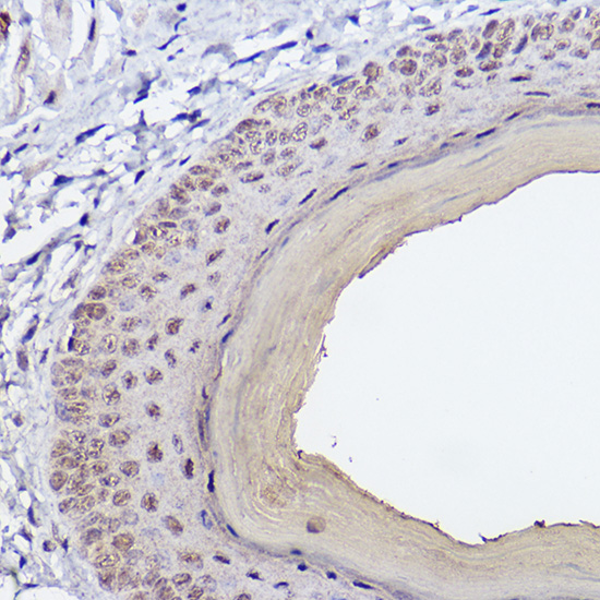 SSCA1/SerpinB3 Rabbit Monoclonal Antibody