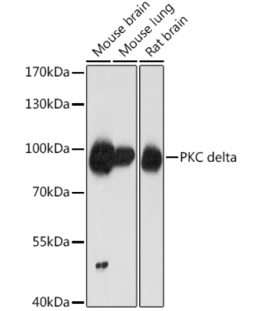 PKC delta Rabbit Polyclonal Antibody