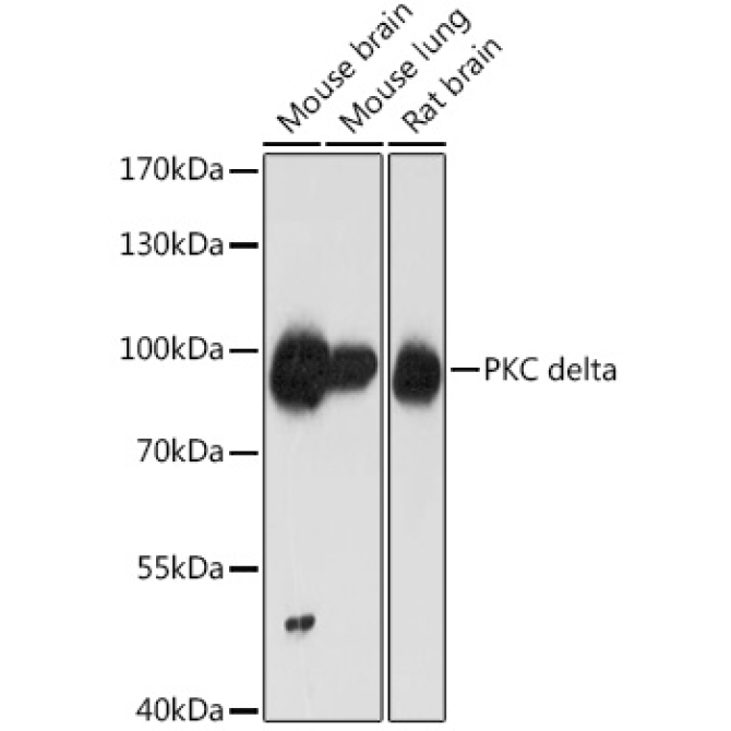 PKC delta Rabbit Polyclonal Antibody