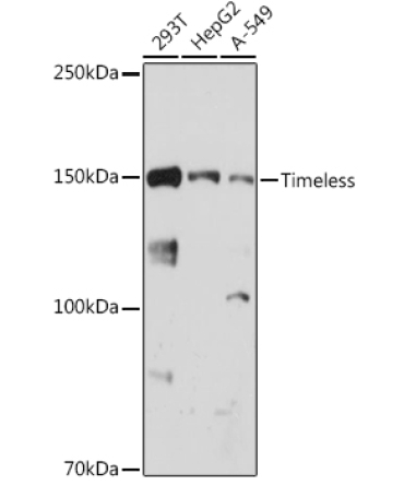 Timeless Rabbit Monoclonal Antibody