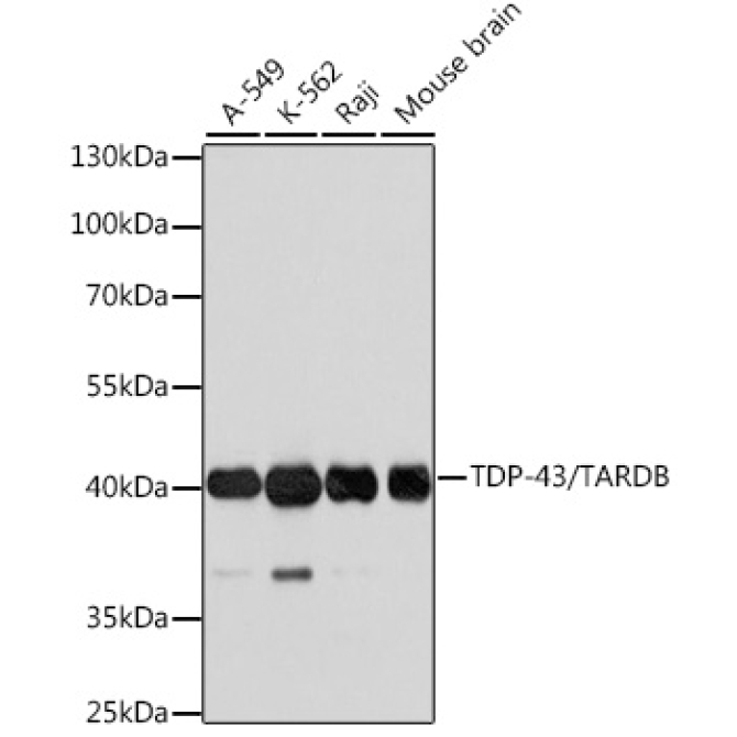TDP-43/TARDBP Rabbit Polyclonal Antibody