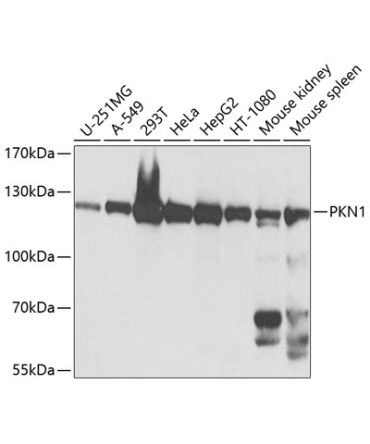 PKN1 Rabbit Polyclonal Antibody