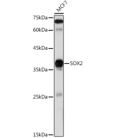SOX2 Rabbit Polyclonal Antibody