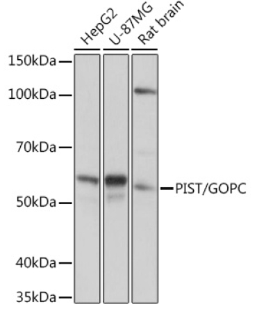 PIST/GOPC Rabbit Monoclonal Antibody
