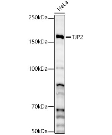 TJP2 Rabbit Polyclonal Antibody