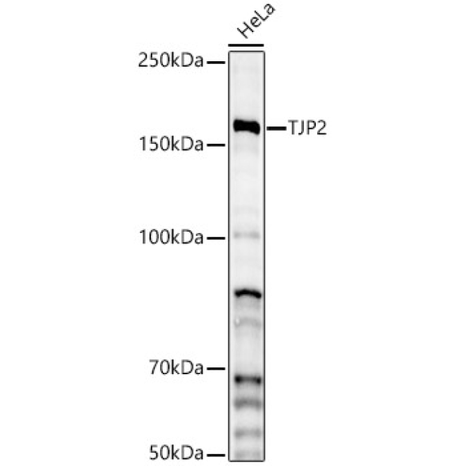 TJP2 Rabbit Polyclonal Antibody