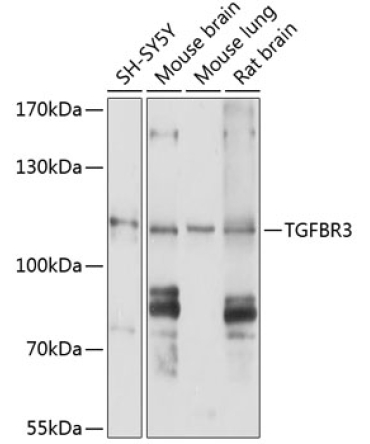 TGFBR3 Rabbit Polyclonal Antibody