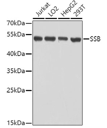 SSB Rabbit Polyclonal Antibody
