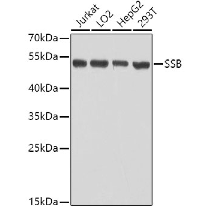 SSB Rabbit Polyclonal Antibody