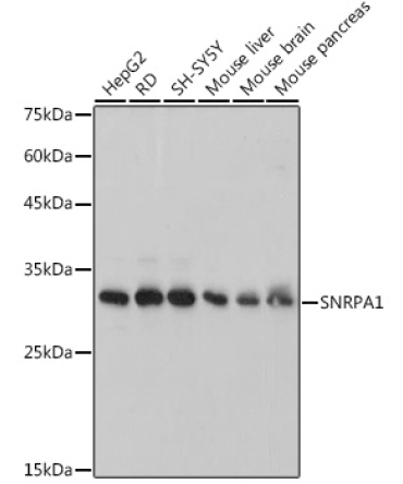 SNRPA1 Rabbit Monoclonal Antibody