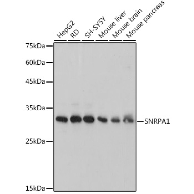 SNRPA1 Rabbit Monoclonal Antibody