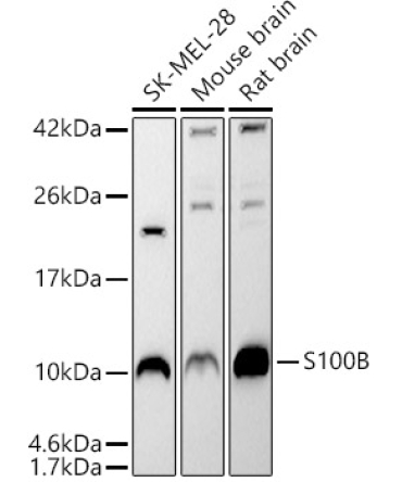 S100B Rabbit Polyclonal Antibody