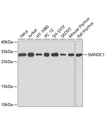 SMNDC1 Rabbit Polyclonal Antibody