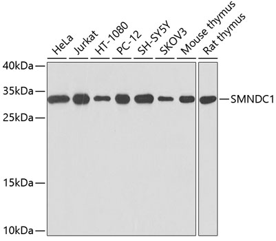 SMNDC1 Rabbit Polyclonal Antibody