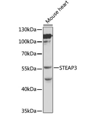 STEAP3 Rabbit Polyclonal Antibody