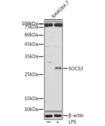 SOCS3 Rabbit Polyclonal Antibody