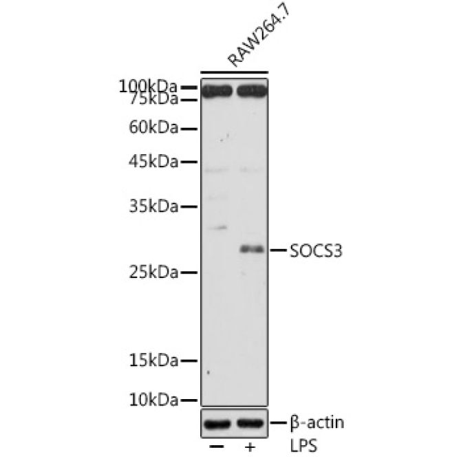 SOCS3 Rabbit Polyclonal Antibody