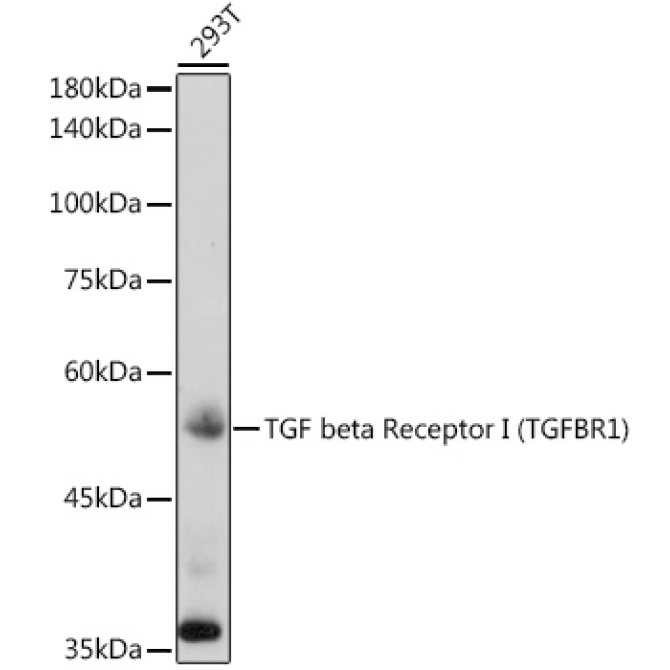TGF beta Receptor I (TGFBR1) Rabbit Polyclonal Antibody