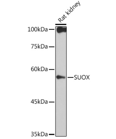 SUOX Rabbit Monoclonal Antibody